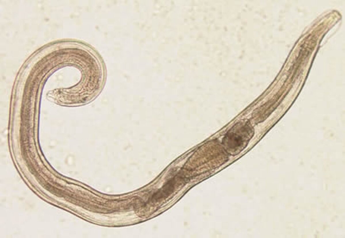 Острица детская Enterobius vermicularis