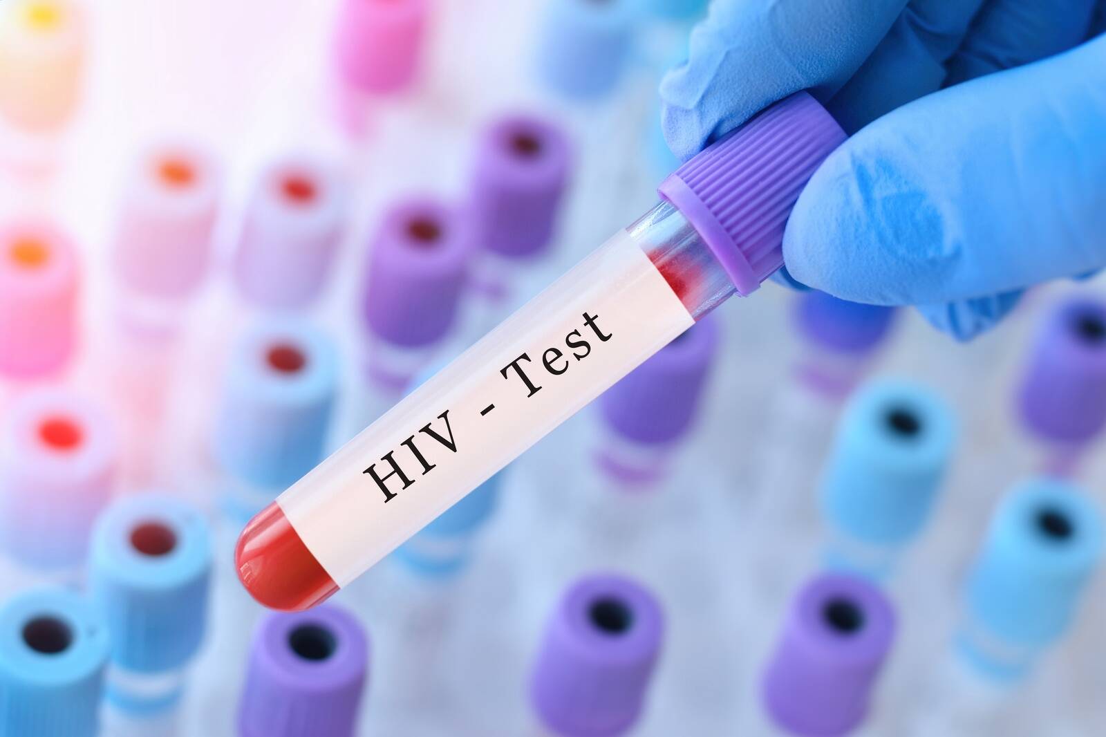 Mullu tehti Eestis terviseameti andmeil 193 133 HIV-nakkuse testi ja registreeriti 133 uut HIV-nakkuse juhtu.