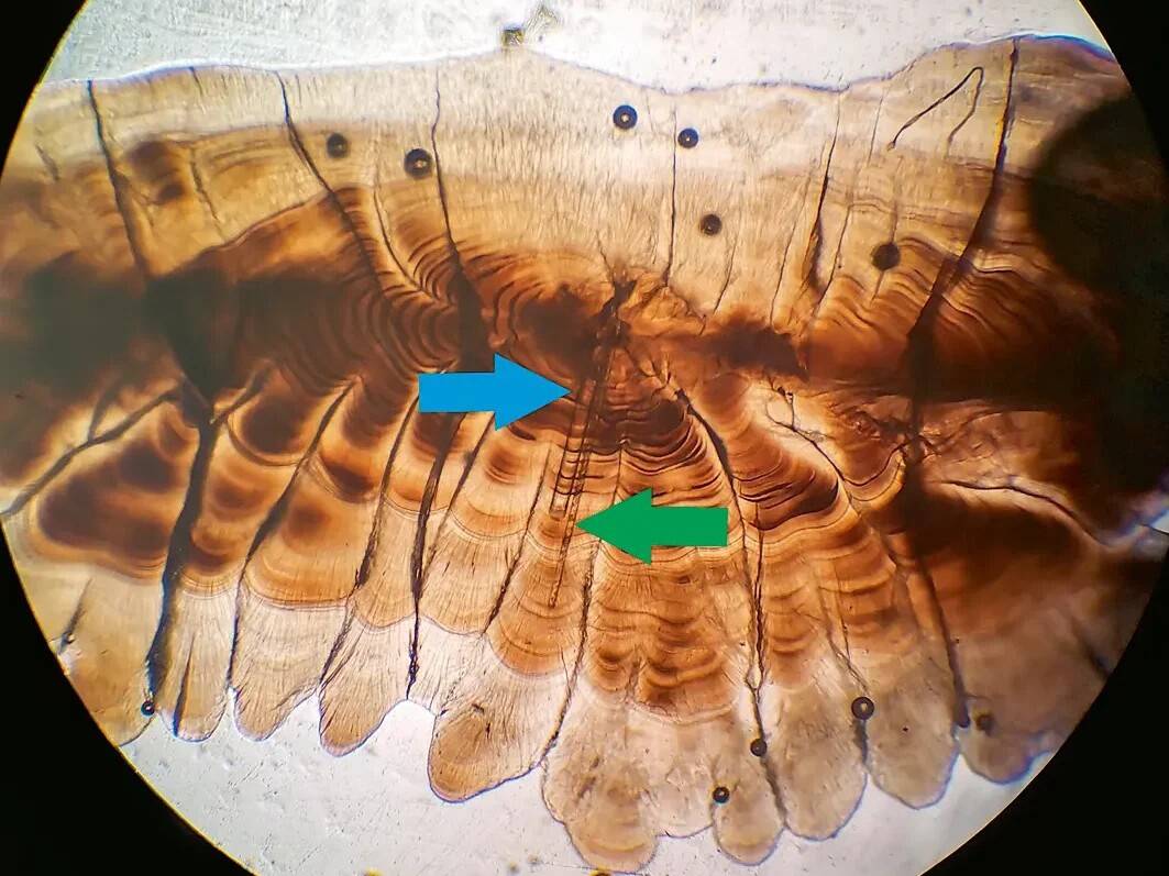 Peipsi järvest püütud täiskasvanud koha prepareeritud ja analüüsitud otoliidi õhik. Näha on otoliidi tuumast alla liikuvat kahte laseri poolt  lõhustatud transekti – vasakpoolne jämedam ca 65 μm läbimõõduga transekt vastab strontsiumi isotoopide analüüsile (sinine nool), parempoolne kitsam ca 40 μm läbimõõduga transekt aga jälgelementide analüüsile (roheline nool). Foto: Mehis Rohtla