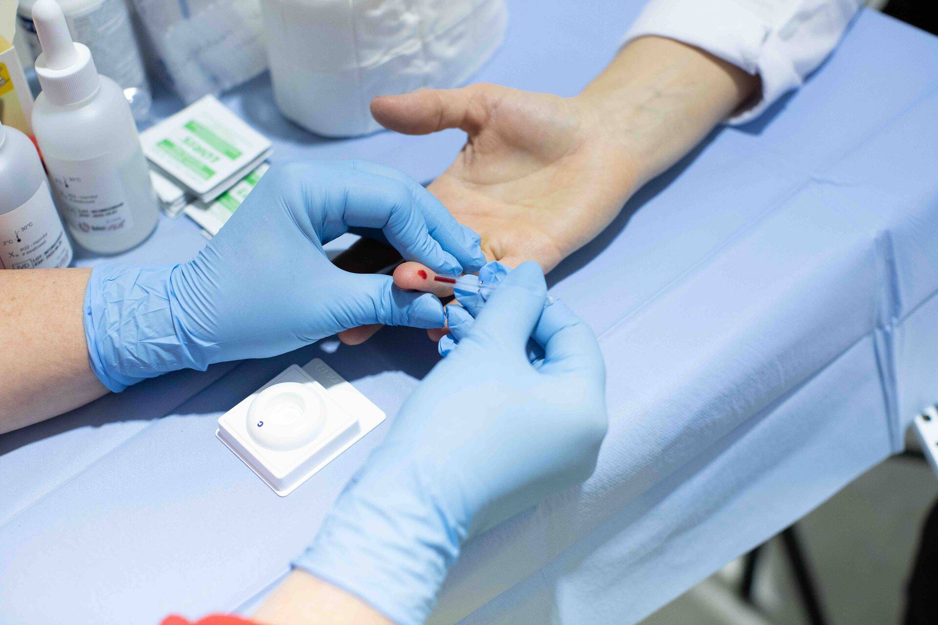 HIV-testi võiks teha vähemalt korra aastas.