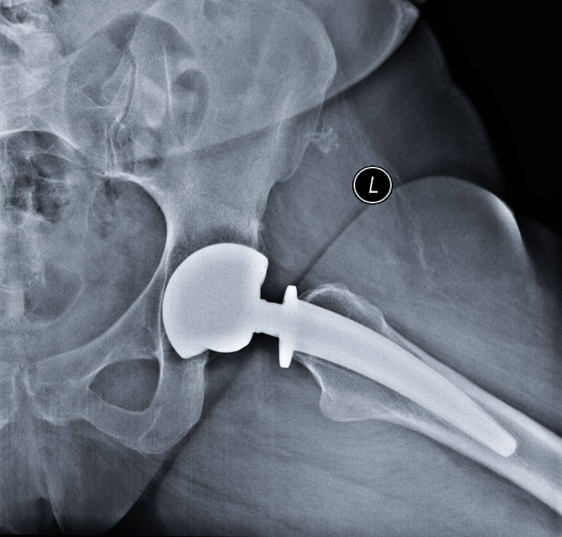 Selle aasta sees loodetakse kõik patsiendid ära opereerida ja ette võtta ka uusi.