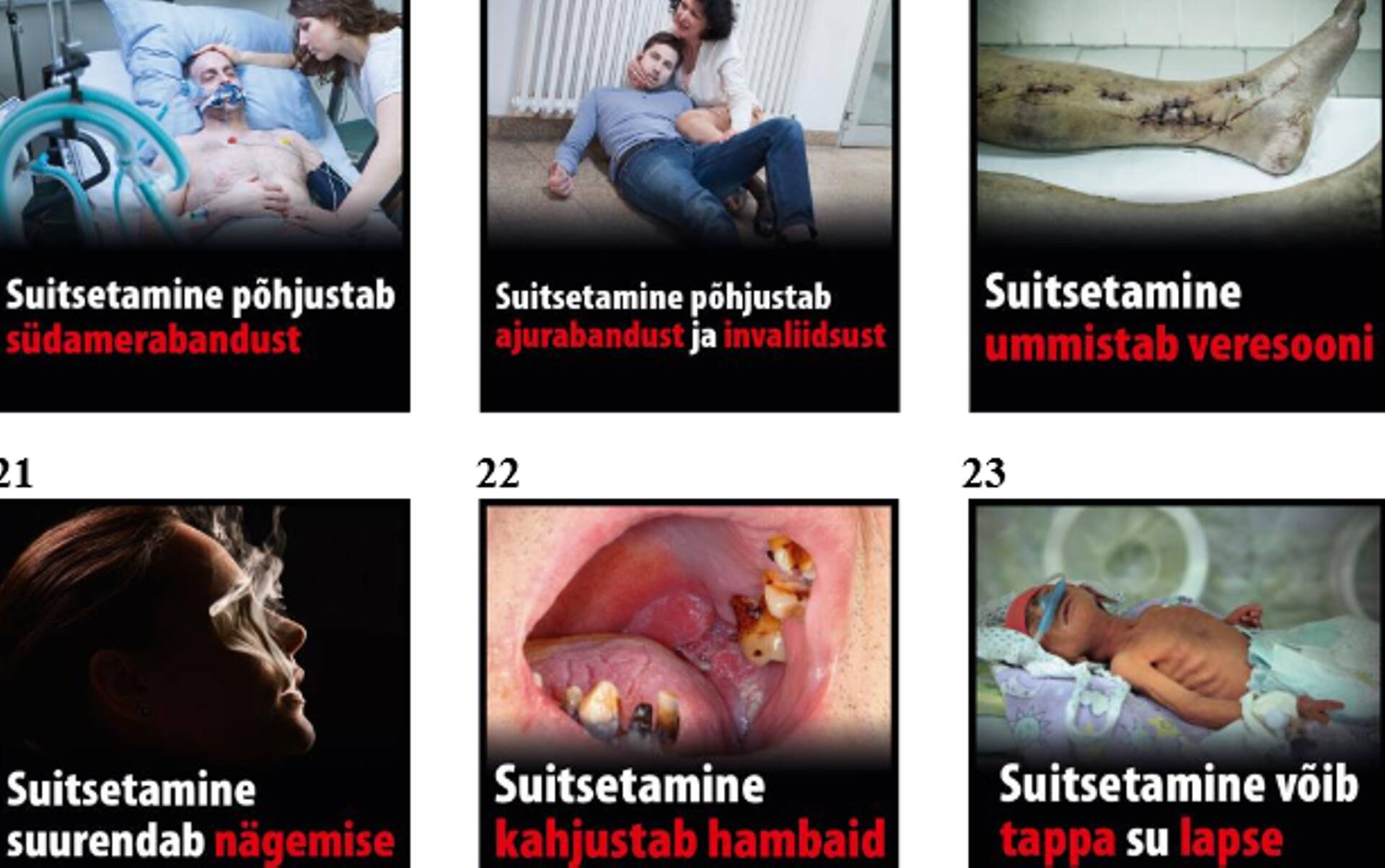 Sigaretipakid saavad karmimad hoiatuspildid.