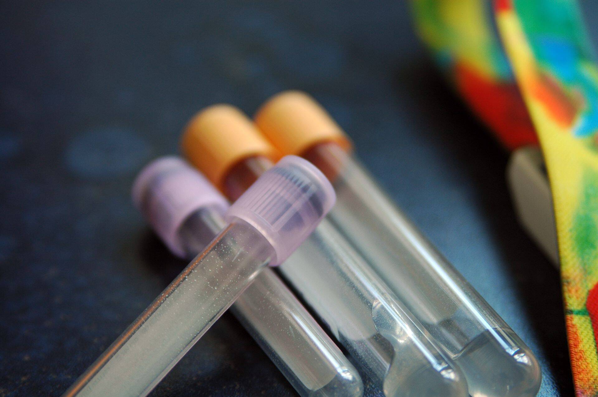 Regionaalhaiglas tehti esimene autoloogne tüvirakkude siirdamine 2006. aastal. Viimastel aastatel on regionaalhaiglas tehtud 35–40 protseduuri aastas.