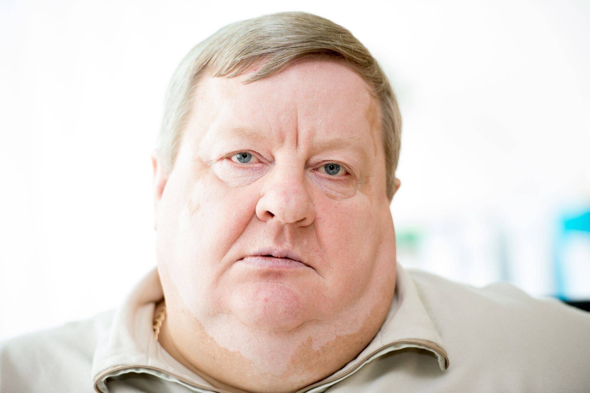 Николай Осипенко жалуется на слабое здоровье, но до сих пор это не возымело успеха.