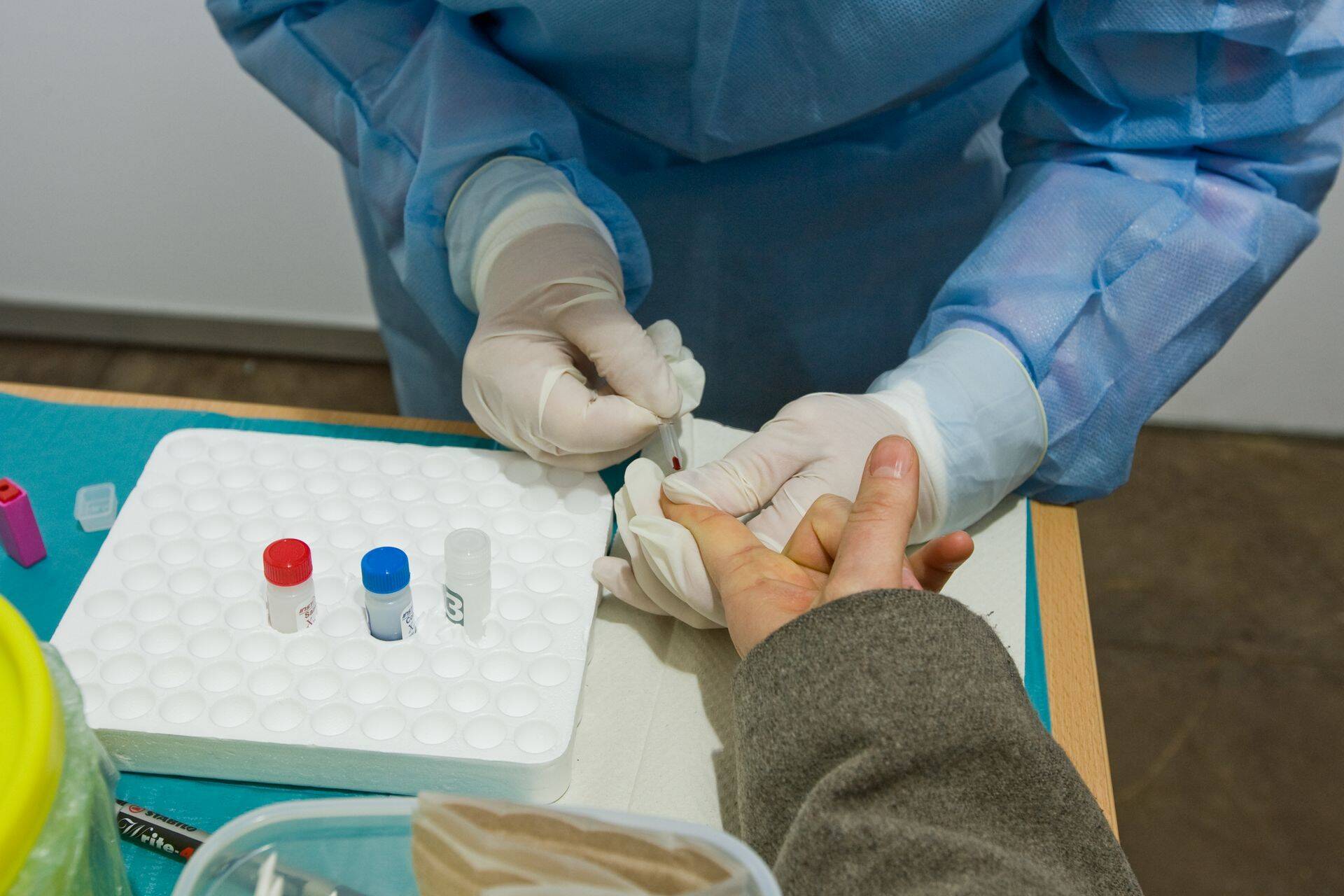 HIV-kiirtestimine