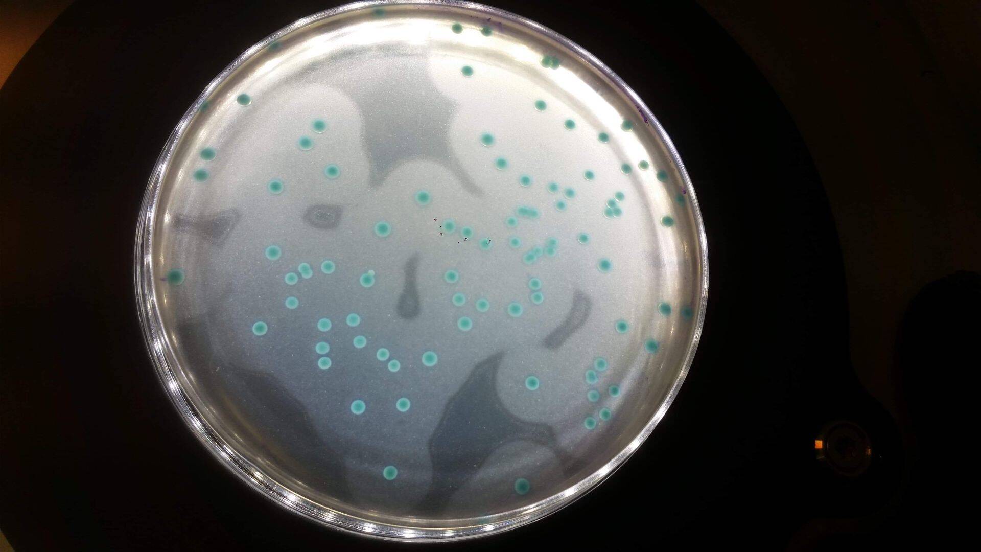 Listeria monocytogenes. Listerioos on üks ohtlikematest toidunakkustest ja võib nõrgestatud immuunsüsteemi korral põhjustada isegi surma