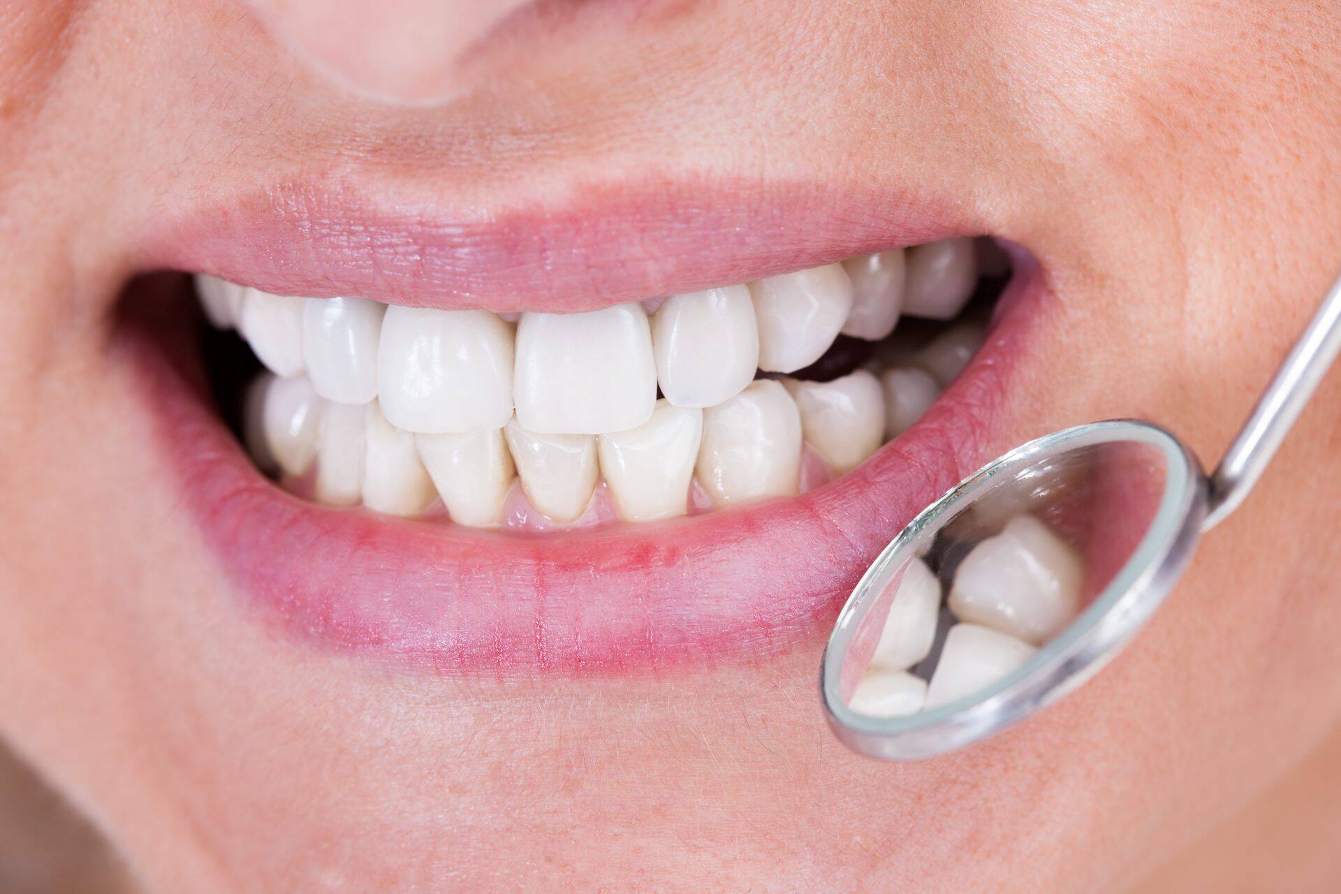 Hambaravi soodustust on tänavu kasutanud üle 200 000 inimese.