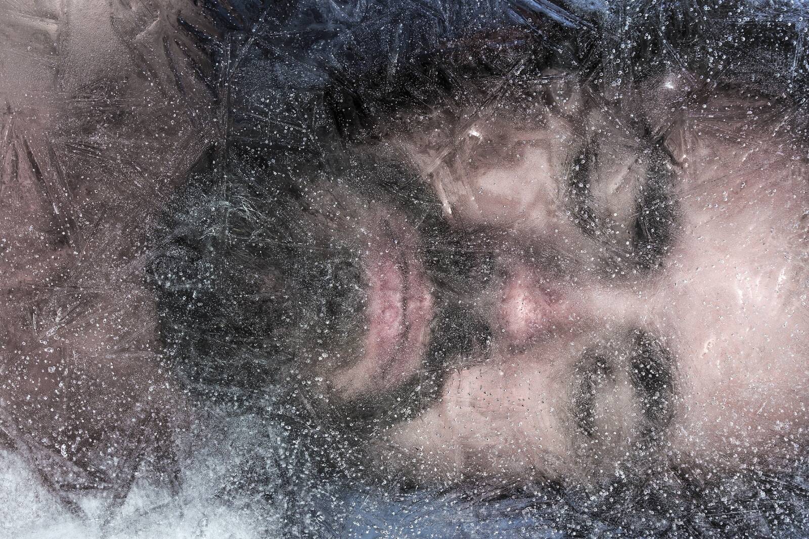 Arstid said külmutamise idee reaalsetest õnnetusjuhtumitest, kus jäises vees uppunuid oli võimalik veel tükk aega hiljem ellu äratada ning neil polnud tõsiseid ajukahjustusi.