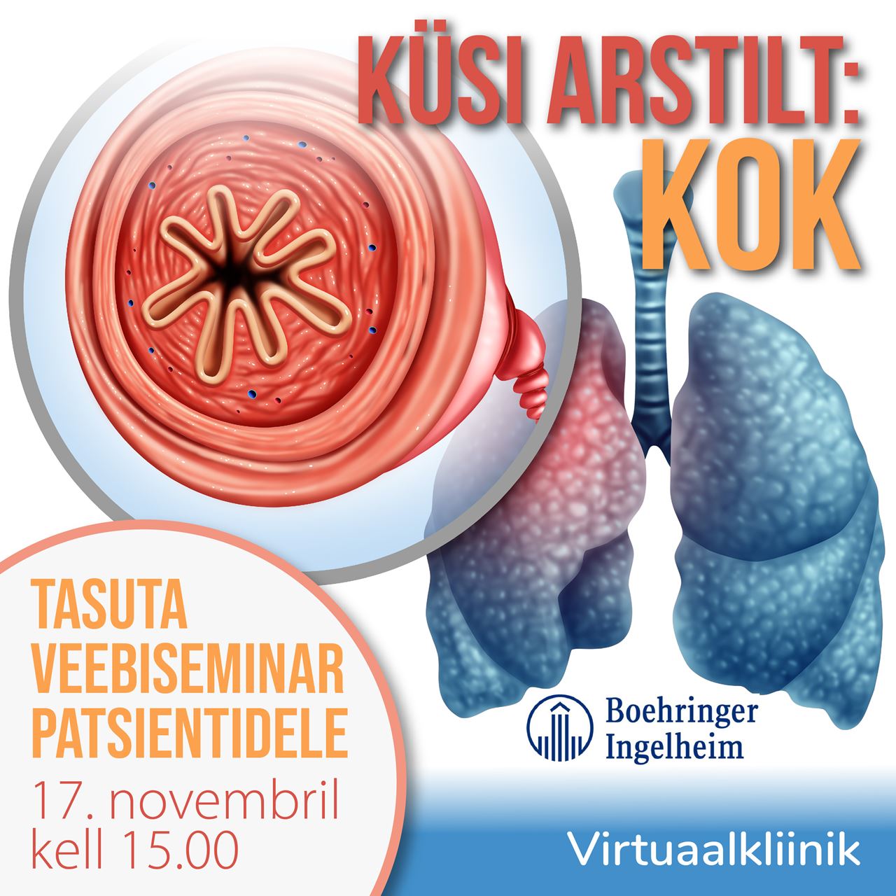 Küsi arstilt: krooniline obstruktiivne kopsuhaigus ehk KOK